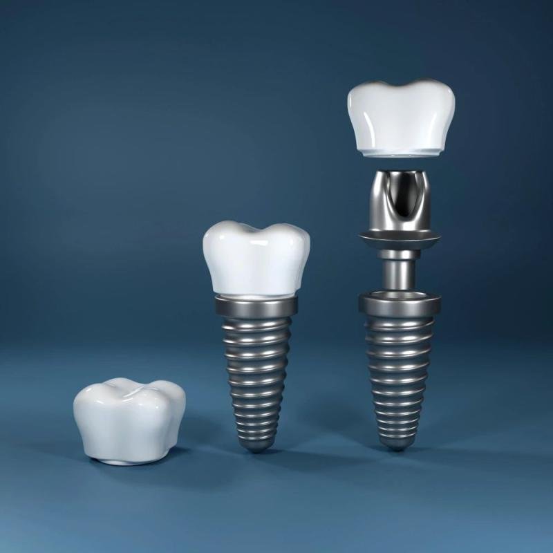 Implantólogos orales en Tampico